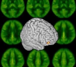 EEG mozku by u lidí s duševní poruchou mělo pomoci zvolit léčbu